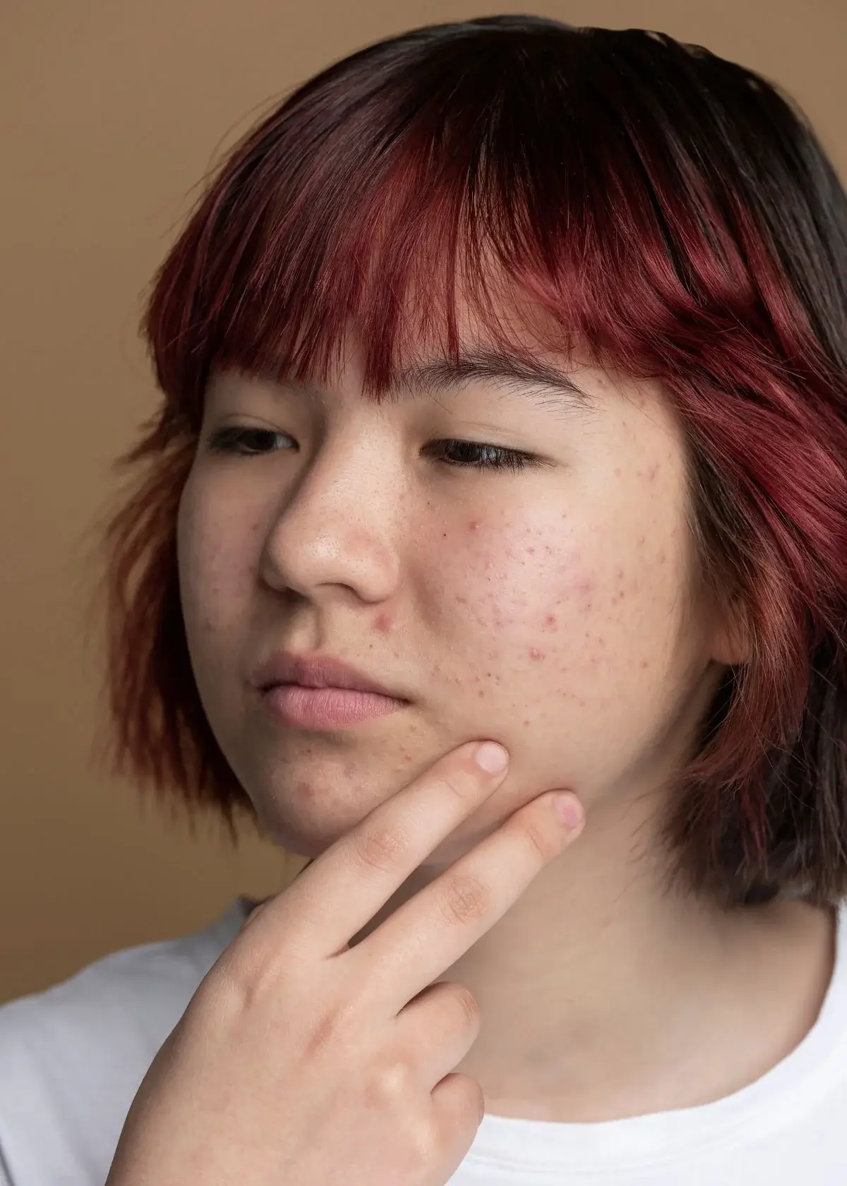 what-type-of-makeup-should-i-use-for-acne-scars