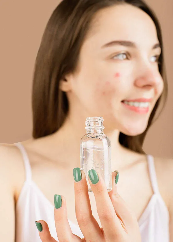 The Prime Time Guide to Banishing Acne Scars with Style!