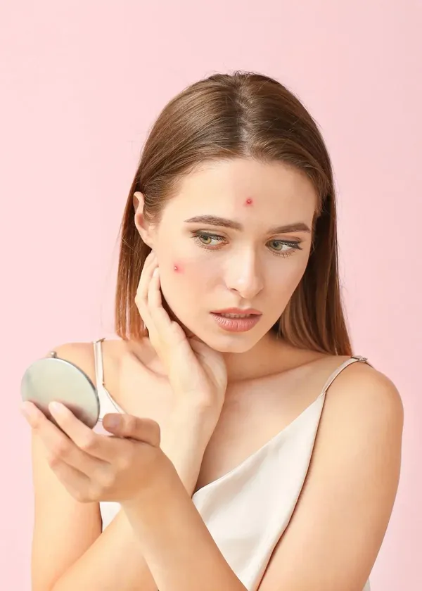 Navigating the Path to Clear Skin: A Comprehensive Guide to Choosing the Optimal Acne Treatment!